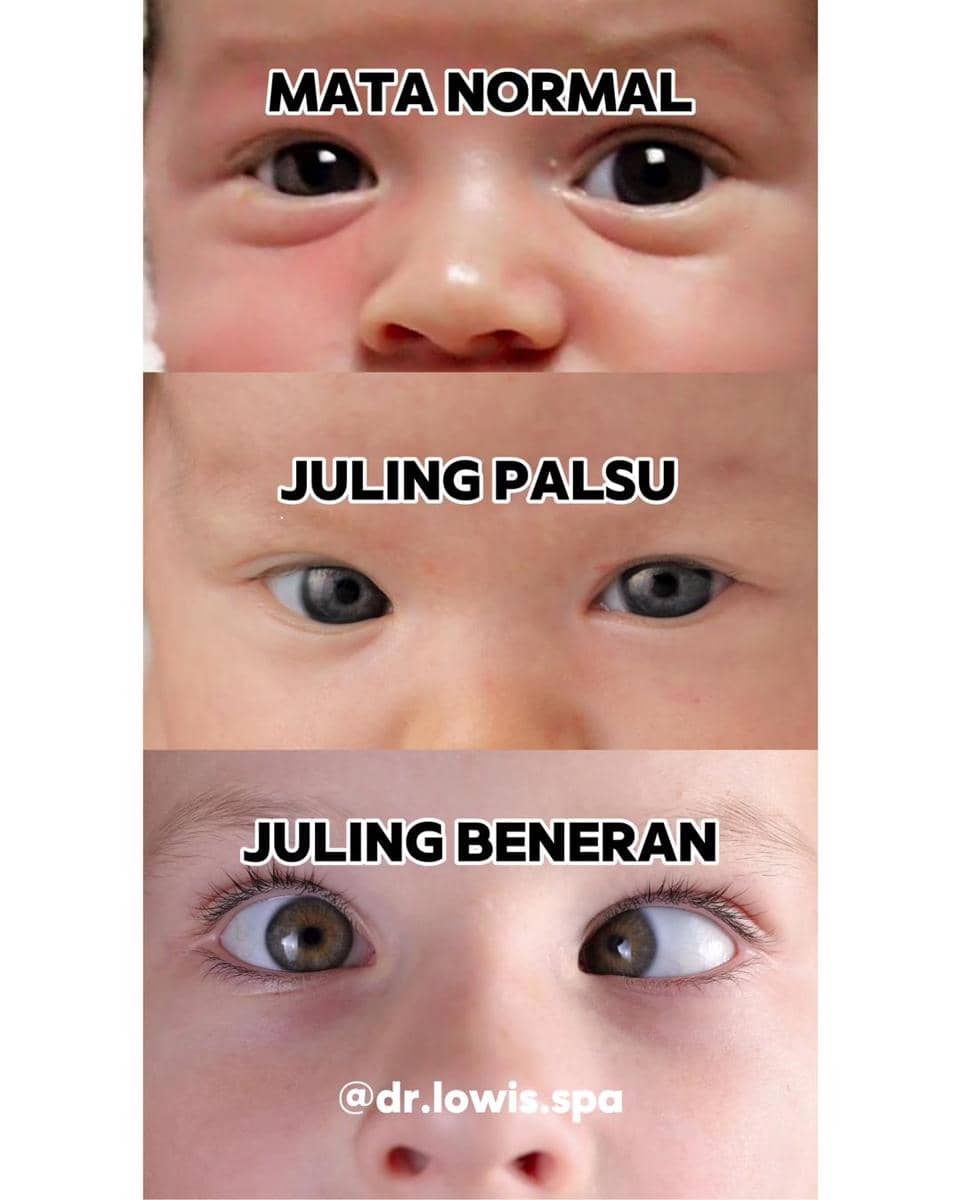 Instagram.com/dr.lowis.spa